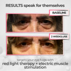 Redalux Eye Revival