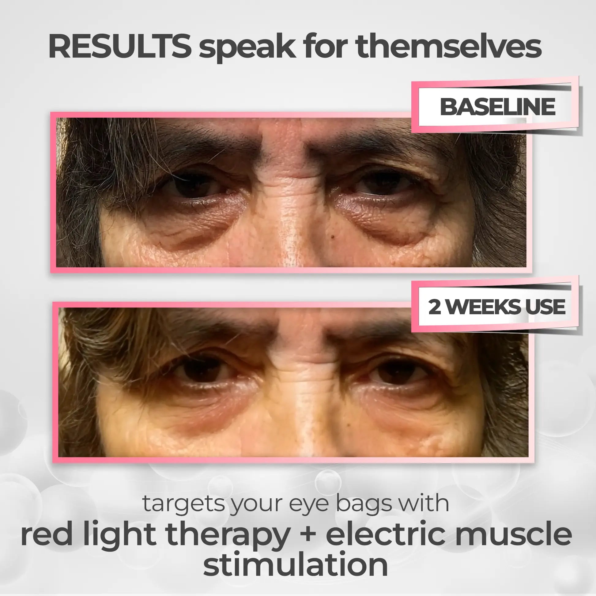 Redalux Eye Revival